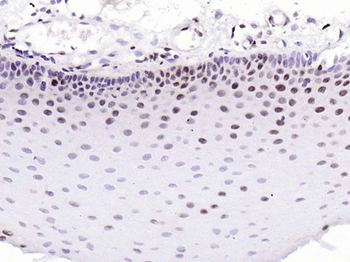 Phospho-CDK2 (Thr160) Rabbit Polyclonal Antibody