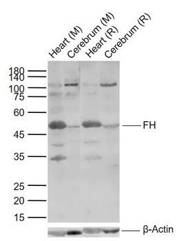 Fumarate hydratase antibody
