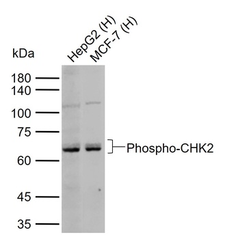 CHK2 (phospho-ser19) antibody