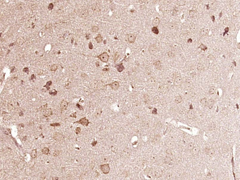 Phospho-Cofilin (Ser3) Rabbit Polyclonal Antibody