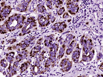 Collagen VI alpha 1 Rabbit Polyclonal Antibody