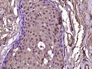 A Raf Rabbit Polyclonal Antibody
