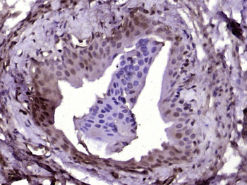 A Raf Rabbit Polyclonal Antibody