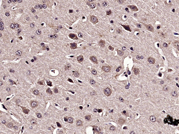 Phospho-CRMP2 (Thr514) Rabbit Polyclonal Antibody