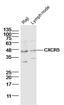 CXCR5 Rabbit Polyclonal Antibody