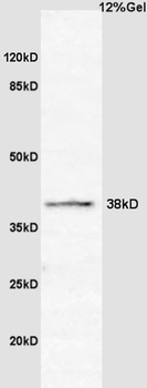 CCNG2 Rabbit Polyclonal Antibody
