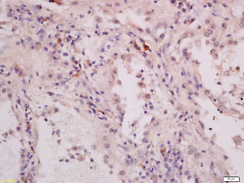 CYP46 Rabbit Polyclonal Antibody
