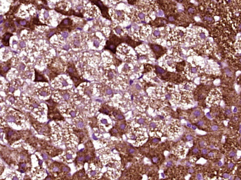 CYP11A1 Rabbit Polyclonal Antibody