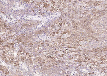 CYP24A1 Rabbit Polyclonal Antibody