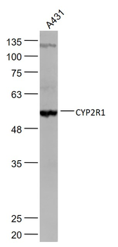 CYP2R1 Rabbit Polyclonal Antibody