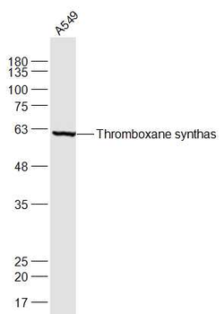 Thromboxane synthase Rabbit Polyclonal Antibody