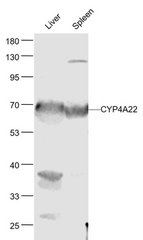 CYP4A22 antibody