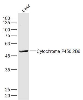 Cytochrome P450 2B6 Rabbit Polyclonal Antibody