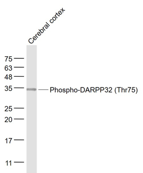 Phospho-DARPP32 (Thr75) Rabbit Polyclonal Antibody