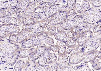 DIO2 Rabbit Polyclonal Antibody