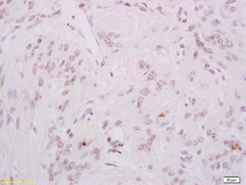 Phospho-DNA PKcs (Ser2056) Rabbit Polyclonal Antibody
