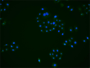 ADAR1 Rabbit Polyclonal Antibody