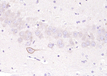 Phospho-PLCG1 (Tyr771) Rabbit Polyclonal Antibody