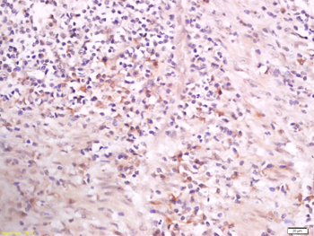 Phospho-PLCG1 (Tyr783) Rabbit Polyclonal Antibody