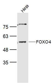 FOXO4 Rabbit Polyclonal Antibody