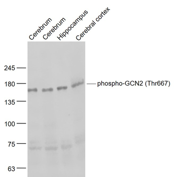 Phospho-GCN2 (Thr667) Rabbit Polyclonal Antibody