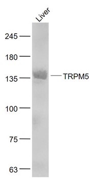 TRPM5 Rabbit Polyclonal Antibody