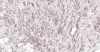 Bax Recombinant Rabbit Monoclonal Antibody