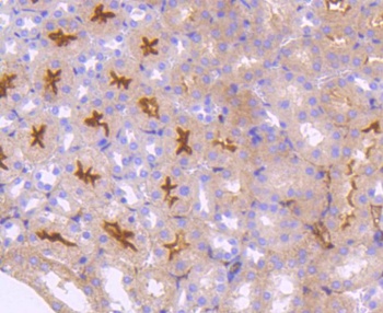 Neuropilin-1 antibody
