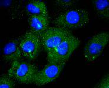 CD14 Recombinant Rabbit Monoclonal Antibody