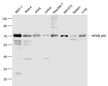NFKB P65 antibody