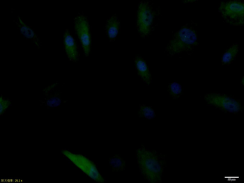 HSP70 Recombinant Rabbit Monoclonal Antibody