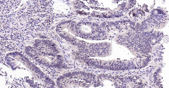 Rad51 Recombinant Rabbit Monoclonal Antibody