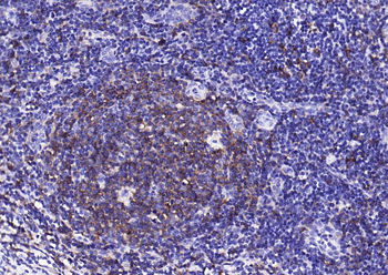 HLA-DQA1 Recombinant Rabbit Monoclonal Antibody
