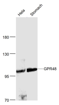 GPR48 Rabbit Polyclonal Antibody