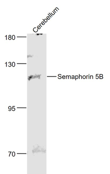 Semaphorin 5B Rabbit Polyclonal Antibody