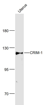 CRIM-1 Rabbit Polyclonal Antibody
