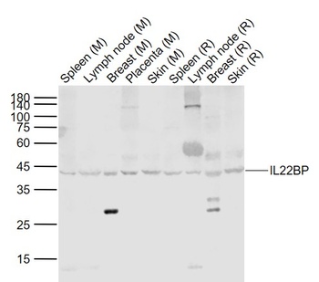 IL22BP antibody