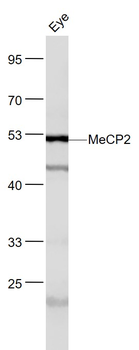 MeCP2 Rabbit Polyclonal Antibody