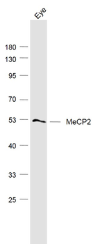 MeCP2 Rabbit Polyclonal Antibody
