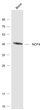 NCF4 Rabbit Polyclonal Antibody