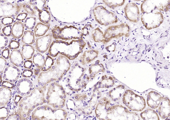 VEGFA Rabbit Polyclonal Antibody