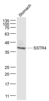SSTR4 Rabbit Polyclonal Antibody
