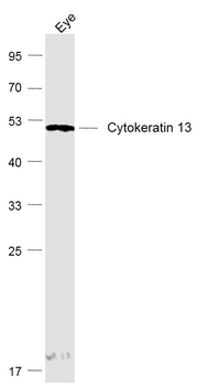 Cytokeratin 13 Rabbit Polyclonal Antibody