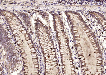 Phospho-STAT3 (Tyr705) Rabbit Polyclonal Antibody