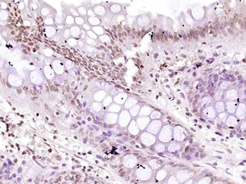 DNA PKcs Rabbit Polyclonal Antibody