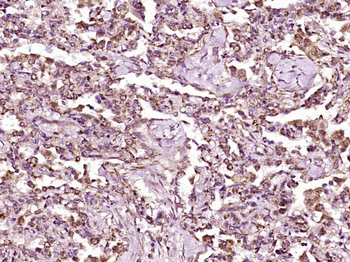 RASSF3 Rabbit Polyclonal Antibody
