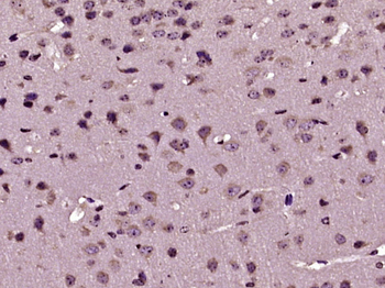 RASSF3 Rabbit Polyclonal Antibody