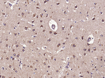 Phospho-GEF H1 (Ser886) Rabbit Polyclonal Antibody