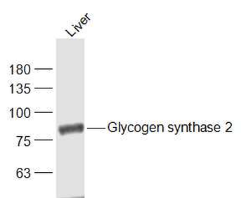 Glycogen synthase 2 Rabbit Polyclonal Antibody