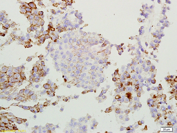 GPNMB Rabbit Polyclonal Antibody